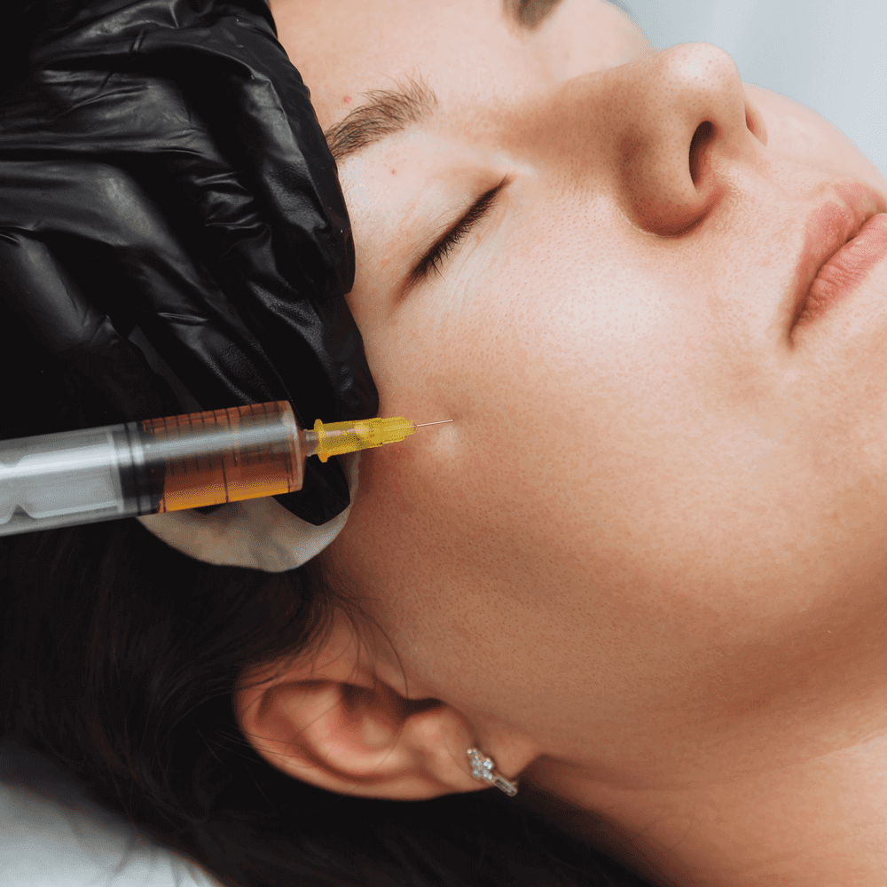 Bio Filler بایو فیلر