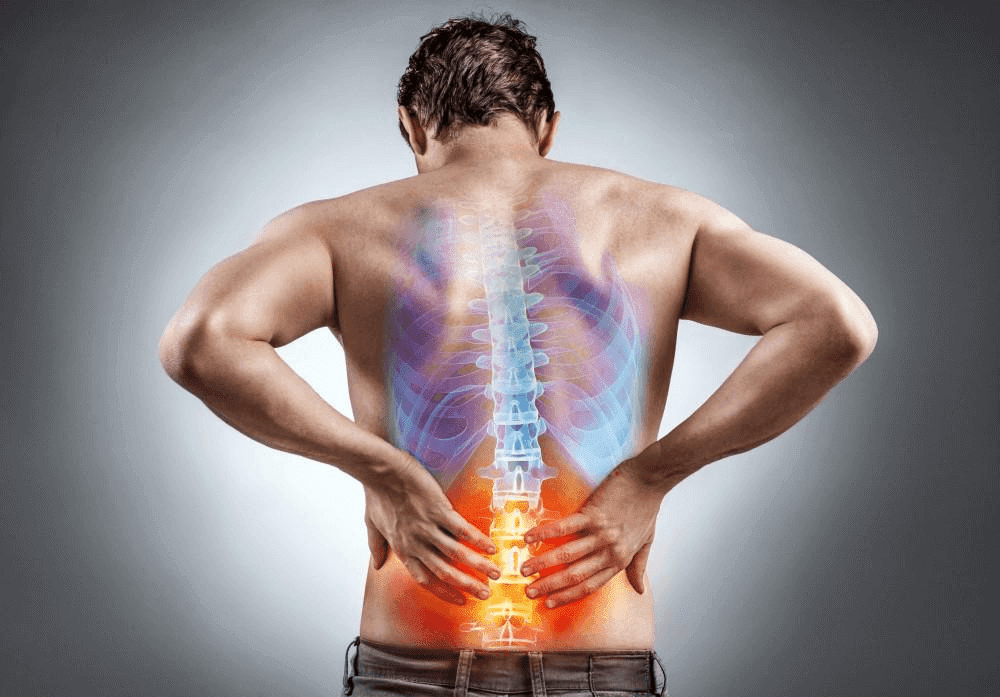 Lumbar spinal stenosis تنگی کانال نخاع