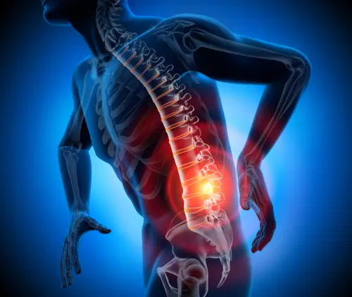 sciatic